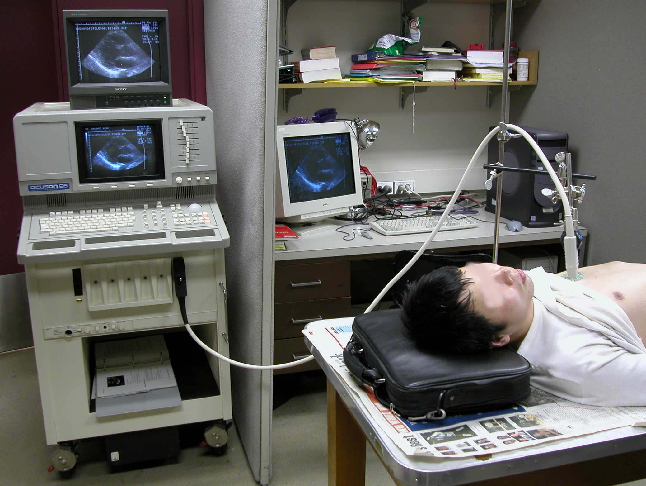  * Cardiac Experiment with the Acuson 128/XP10 Ultrasound Imaging System * 